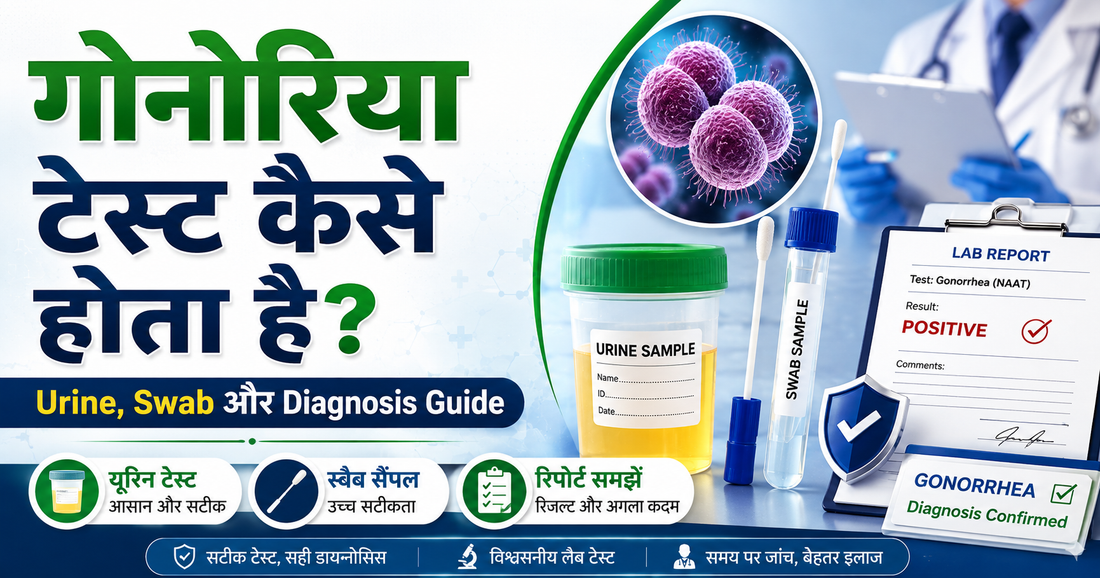 Gonorrhea testing - NAAT urine swab culture and diagnosis guide