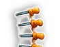 Ankylosing Spondylitis